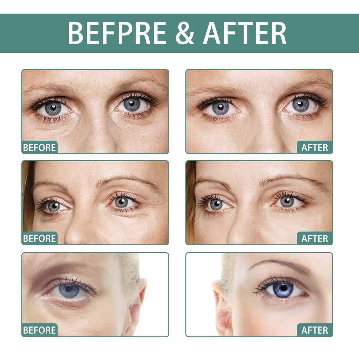 Revitalize Your Look with Firming Eyes Cream Stick, Anti-Aging, Dark Circles, Wrinkle Repair ,4g