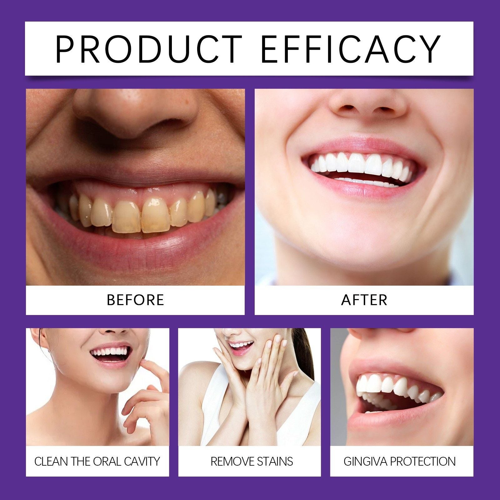 Purple Teeth Whitening Powder 50g