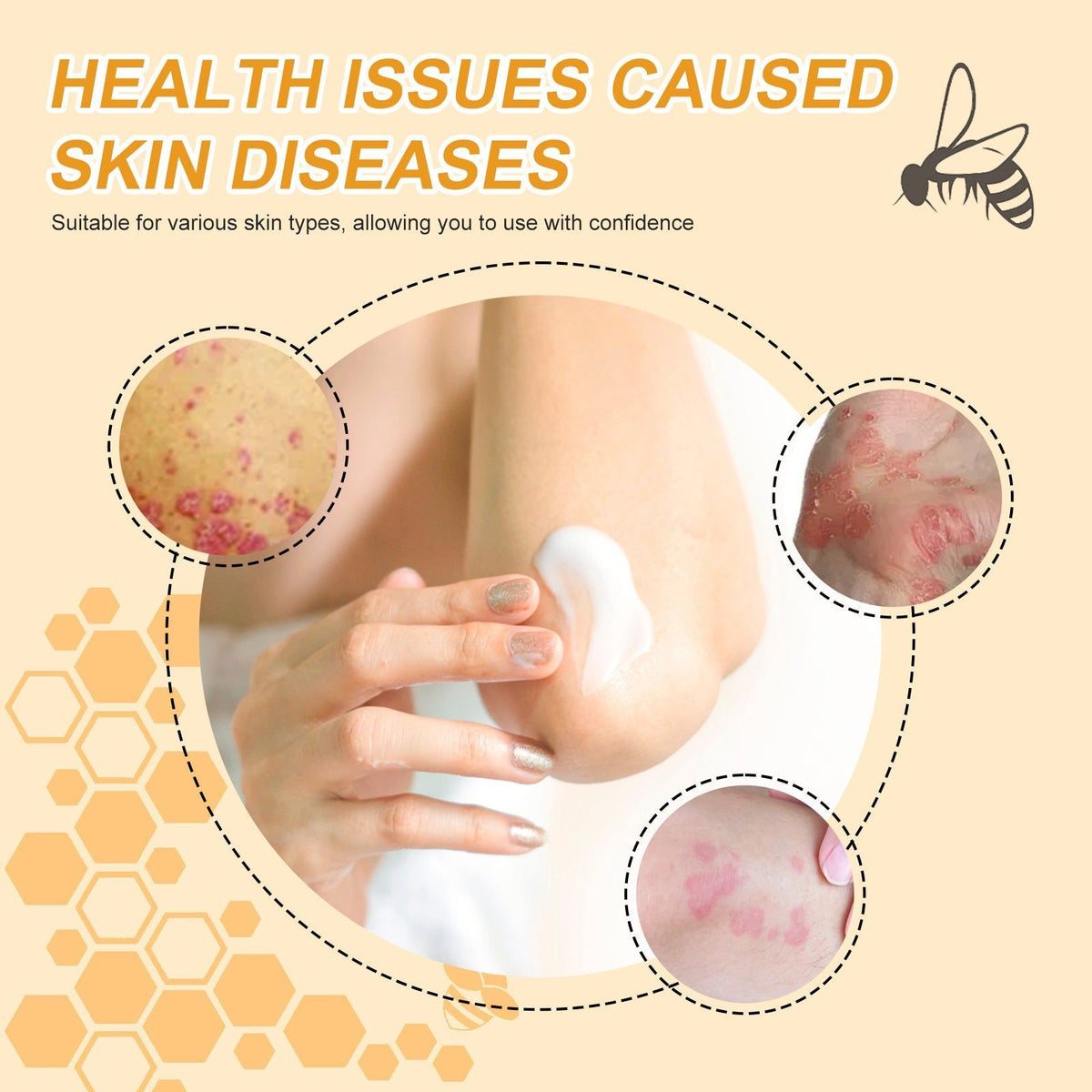 Bee Venom Cream for Glowing Skin, Hydrating, Soothing, Anti-Aging, All Skin Types ,30g