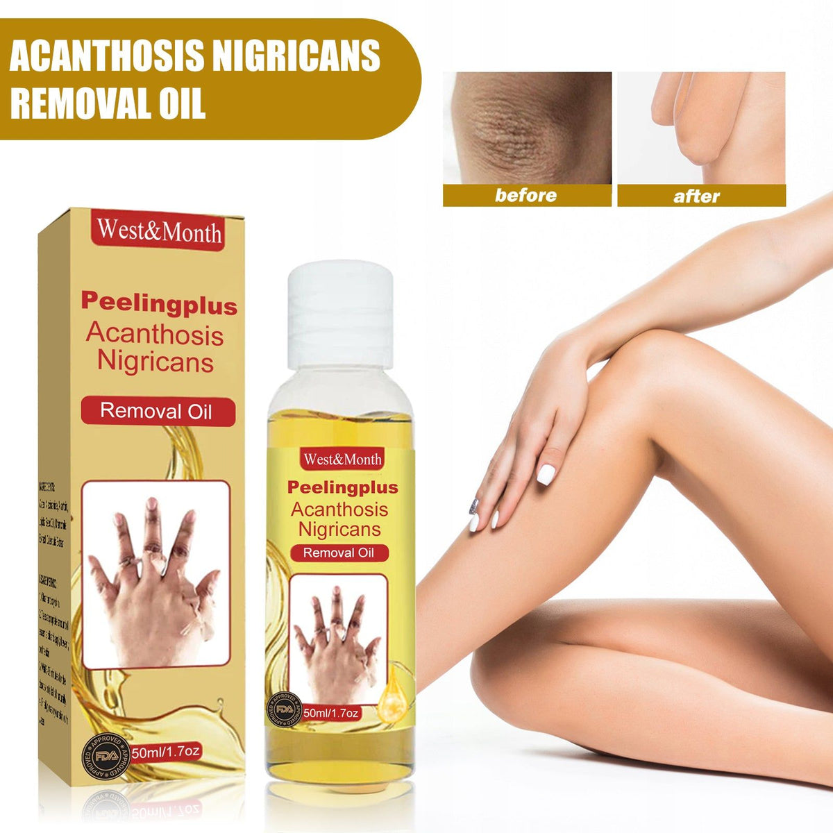 Acanthosis Nigricans Removal Oil, Brightening Skin, Dark Spot Corrector, Natural Exfoliating, Skin Lightening, Melanin Reducer ,50ml