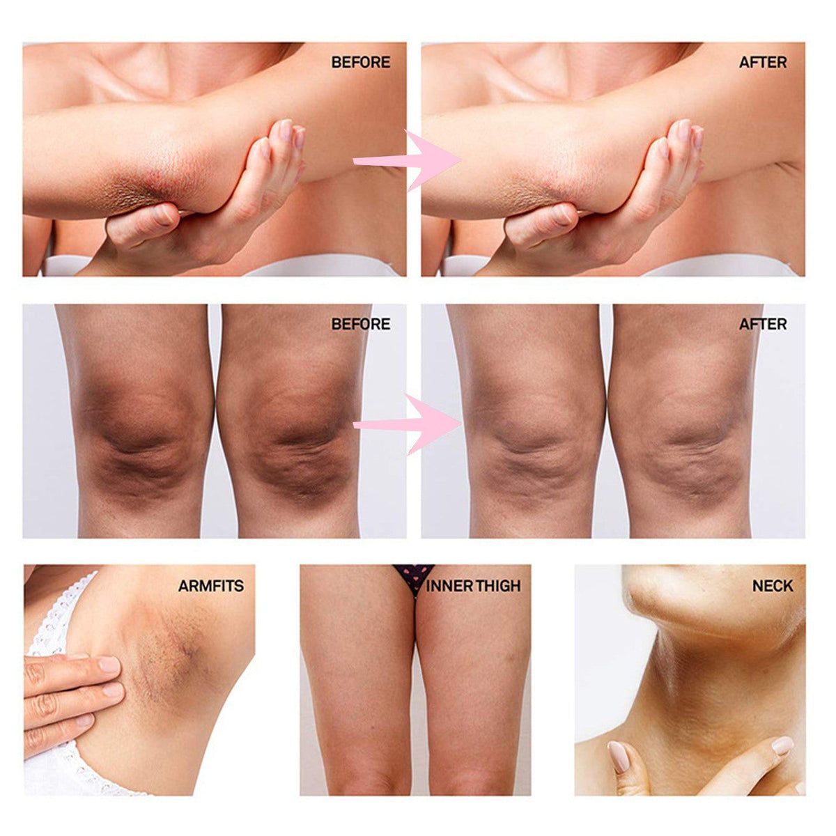 Brighten White Body and Underarms, Intimate Corrective Cream for Dark Skin, Moisturizing and Repair ,30ml