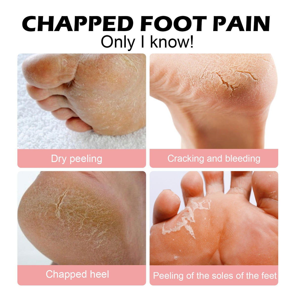 Prevent Dry Hands and Feet from Cracking, Deep Moisturizer with Vitamin E, Shea Butter ,40g