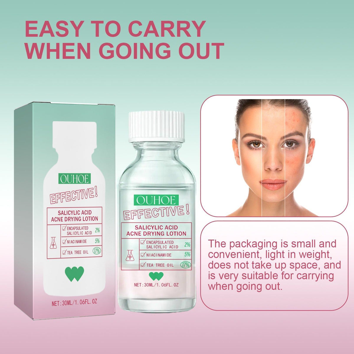 Revitalize and Repair Skin with Salicylic Acid Acne Lotion, Clear Pores, Moisturize, Brighten ,1set