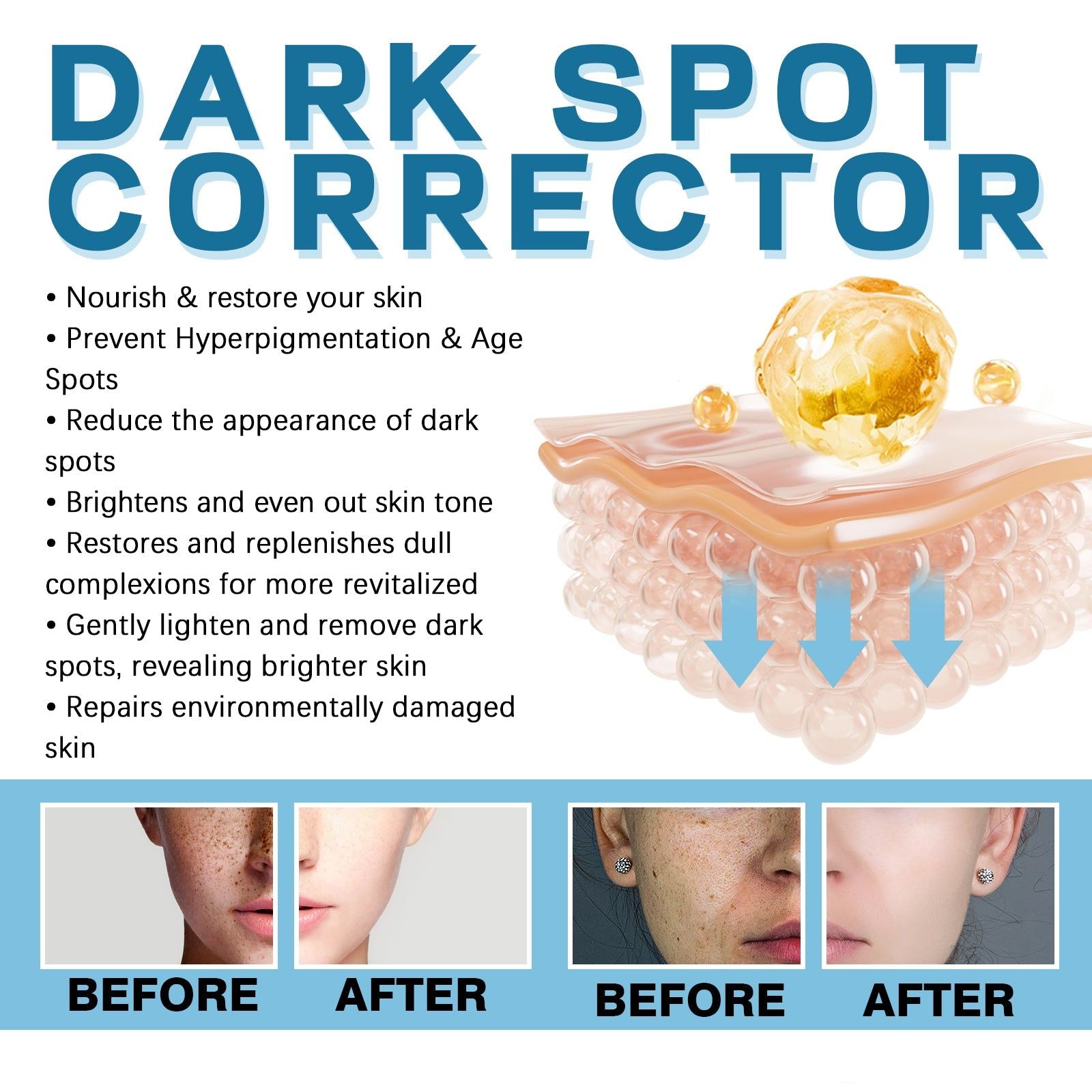 Brightening Dark Spot Corrector, Even Skin Tone, Melasma Repair, Acne Scar Fade ,55ml