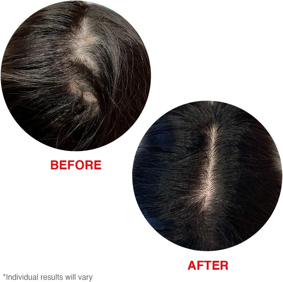 HAIRtamin Scalp Serum Natural Hair Growth 60ML