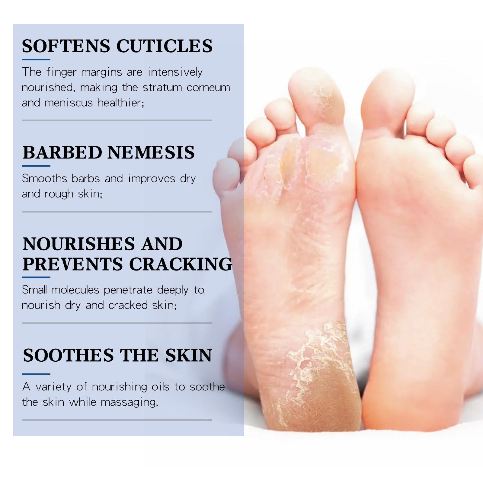 Urea Moisturizing Cream for Dry Skin, Hand and Foot Care, Deep Nourishing, Repair and Prevent Chapping ,30ml