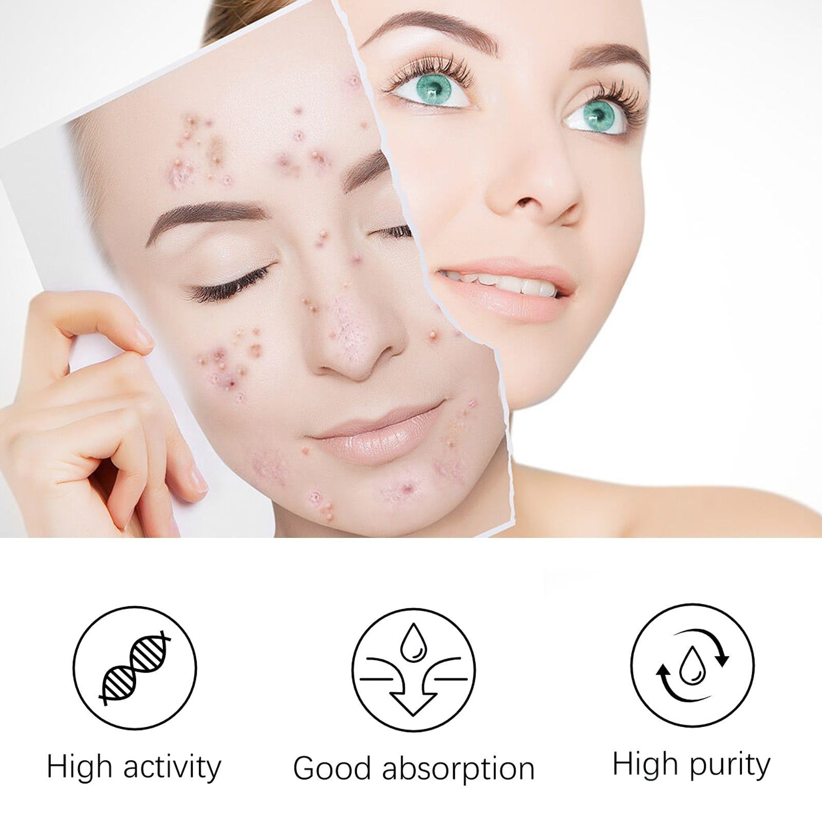 Overnight Acne Repair Patches, Clear Pimples Fast, Reduce Scars, Gentle Skin Care ,20patches