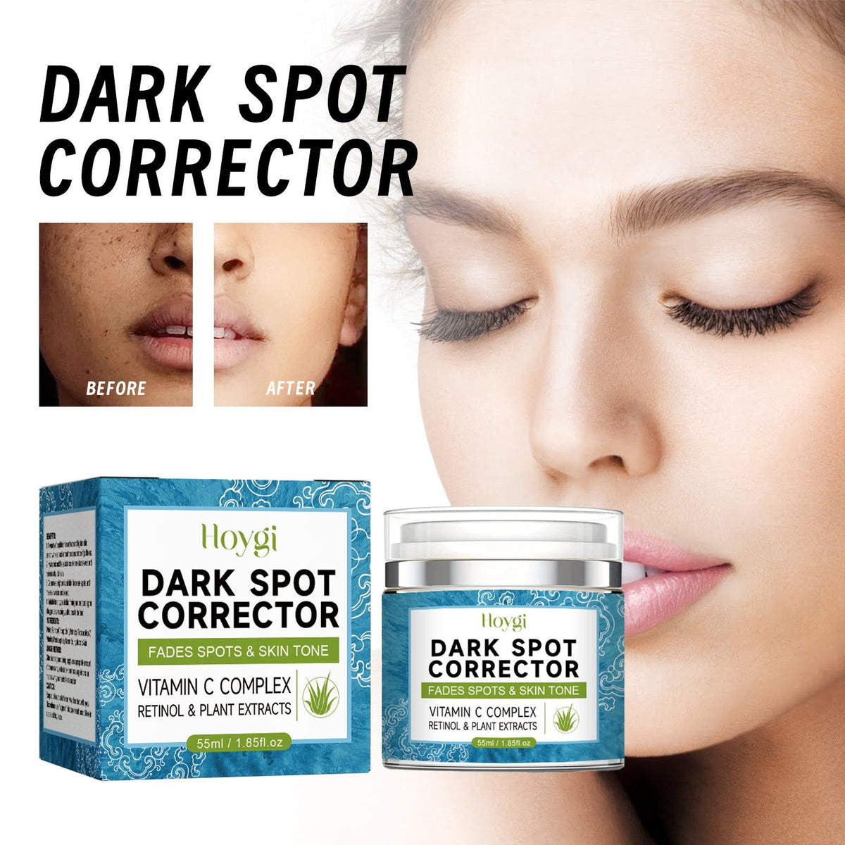 Brightening Dark Spot Corrector, Even Skin Tone, Melasma Repair, Acne Scar Fade ,55ml