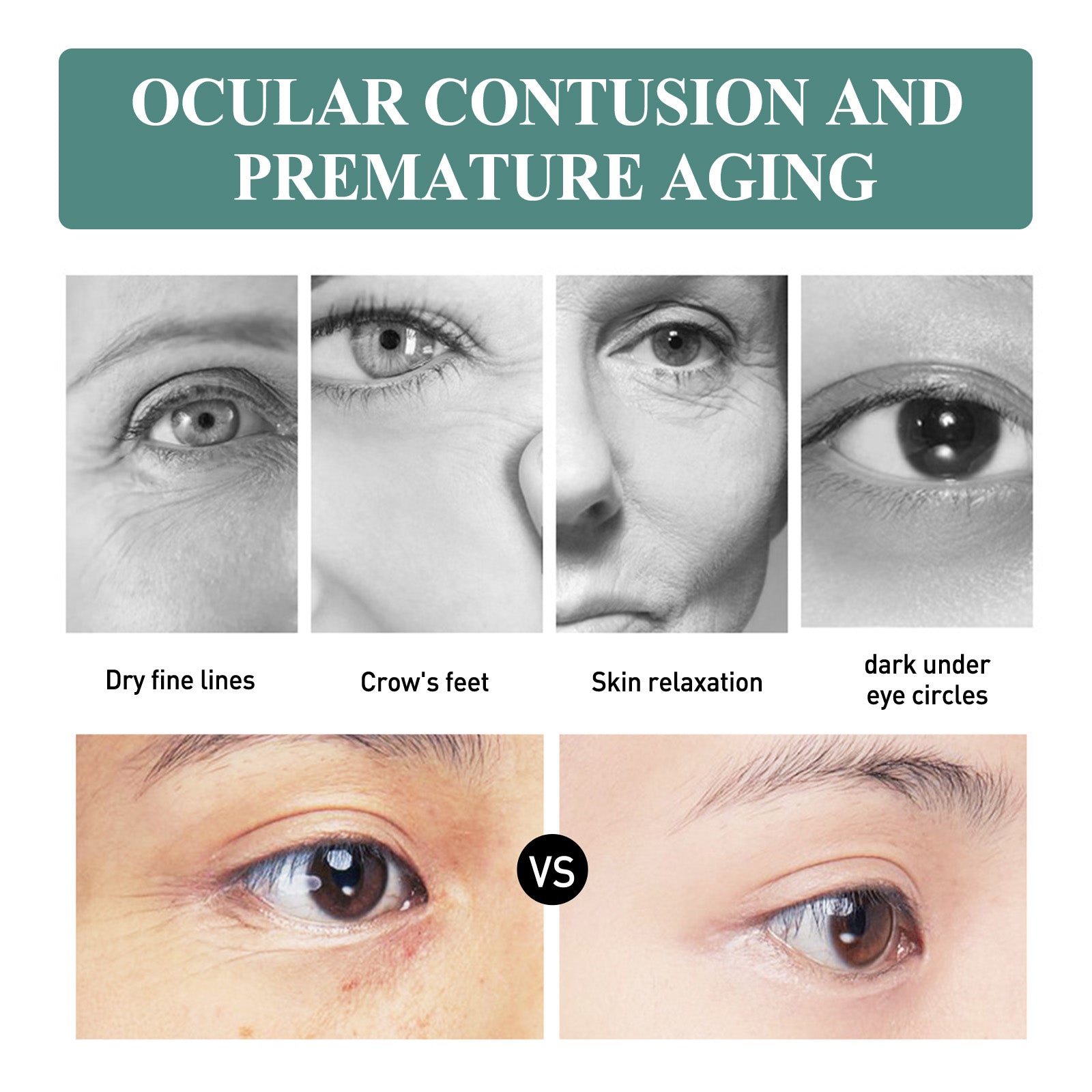 Revitalize Your Look with Firming Eyes Cream Stick, Anti-Aging, Dark Circles, Wrinkle Repair ,4g