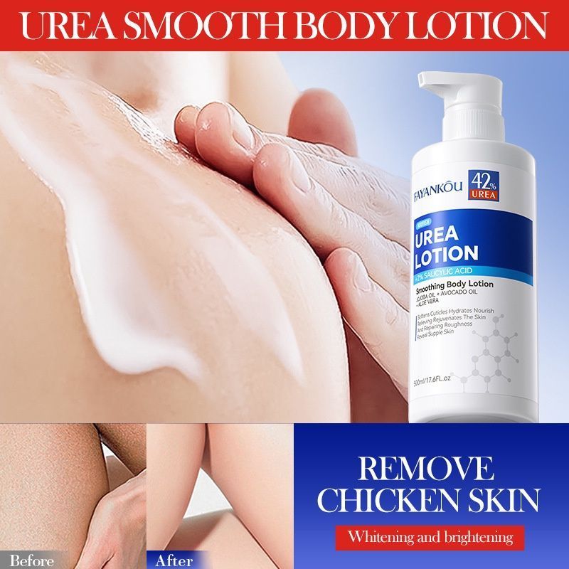 Urea moisturizing body lotion, moisturizes body skin-001-FYK40527