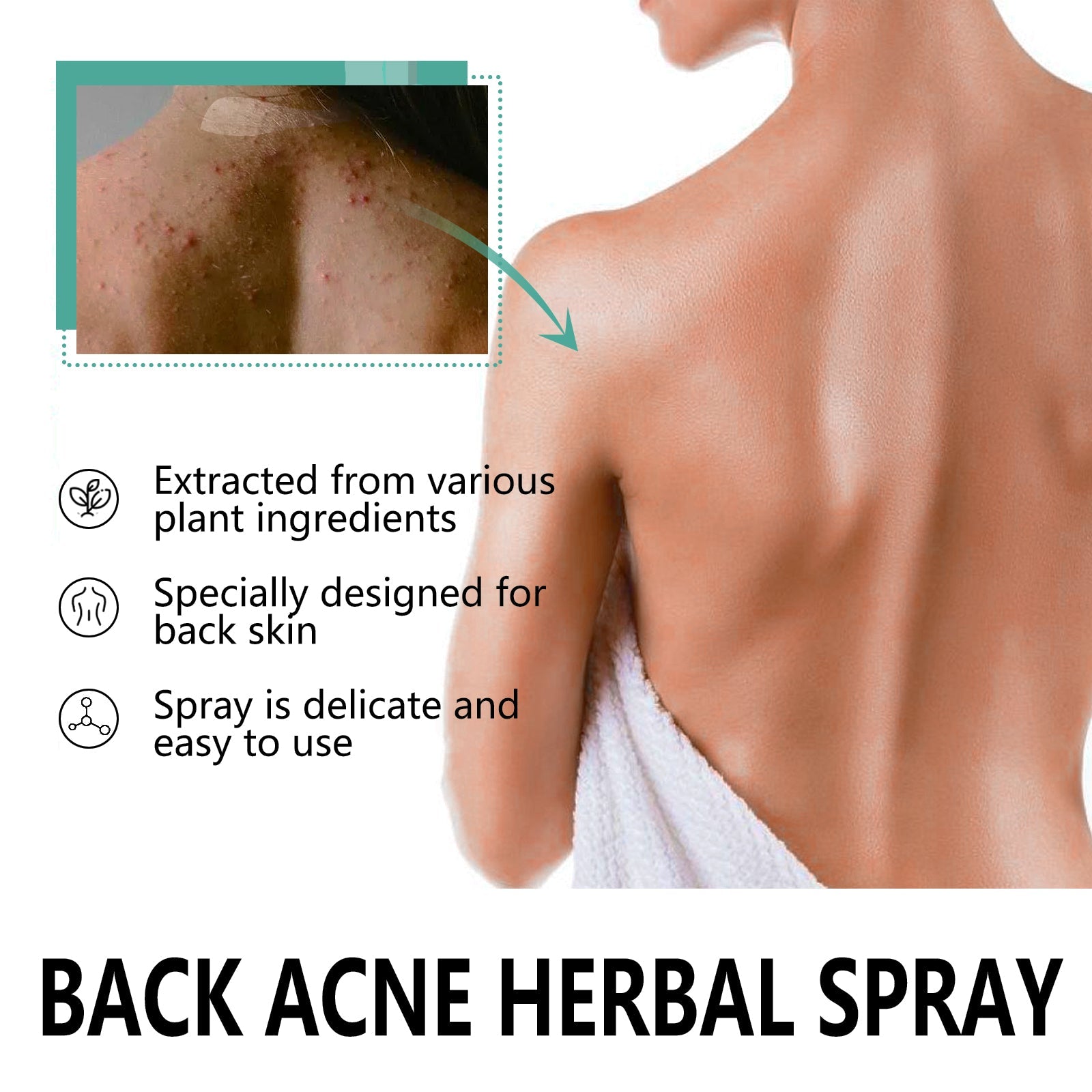 Oce Aura Back Acne Herbal Spray, Repair Acne Marks, Clear Skin, Natural Acne Solution ,120ml