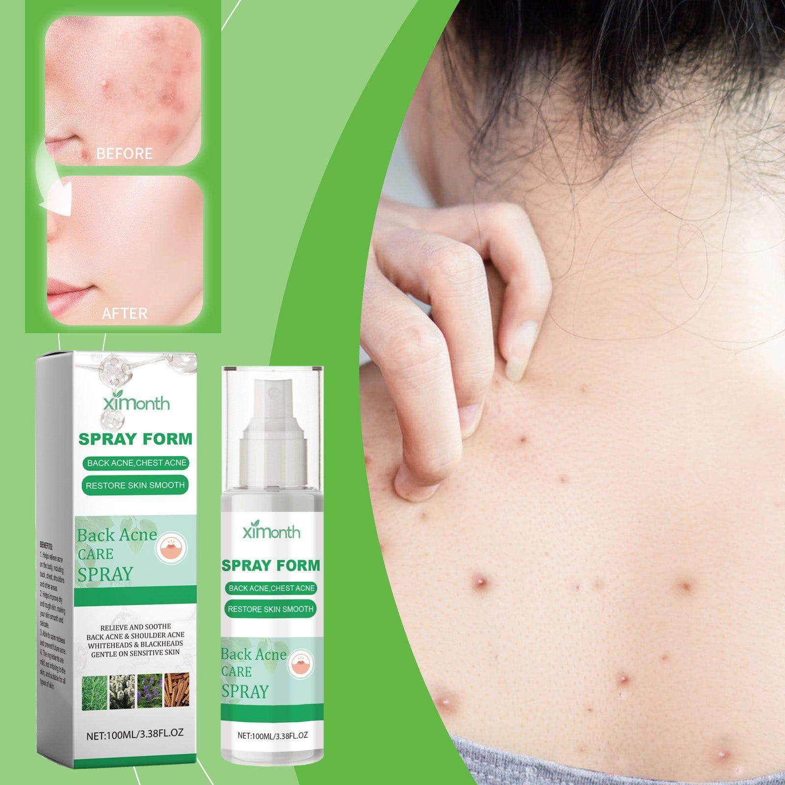 Salicylic Acid Body Herbal Spray, Acne & Skin Hydrating, Refreshing, Soothing, Natural Skincare ,100ml
