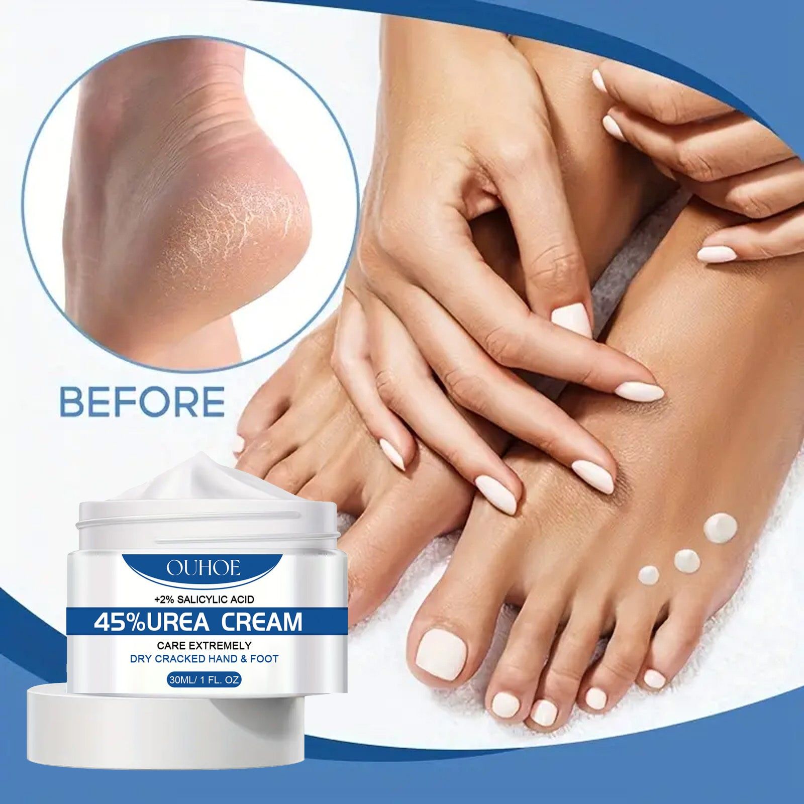 Urea Moisturizing Cream for Dry Skin, Hand and Foot Care, Deep Nourishing, Repair and Prevent Chapping ,30ml