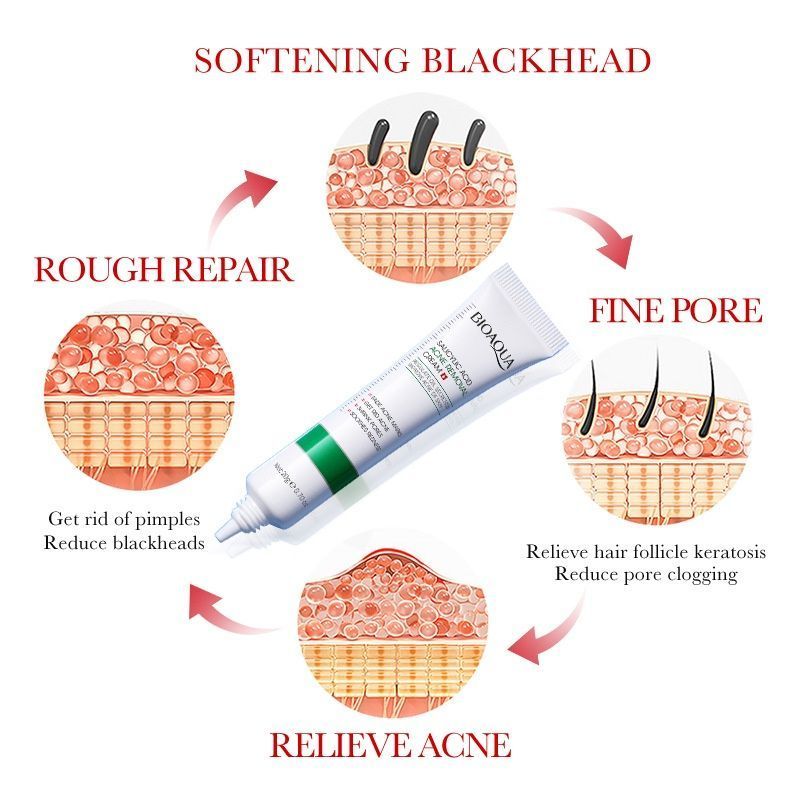 Salicylic Acid Moisturizing Face Cream for Acne & Scar Fading - BQY49044