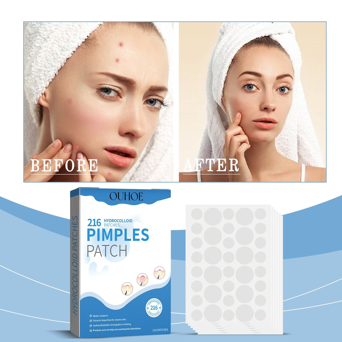 Fast Pimple Repair Patch, Acne Spot Treatment, Waterproof Breathable Skin Cover ,216 pieces