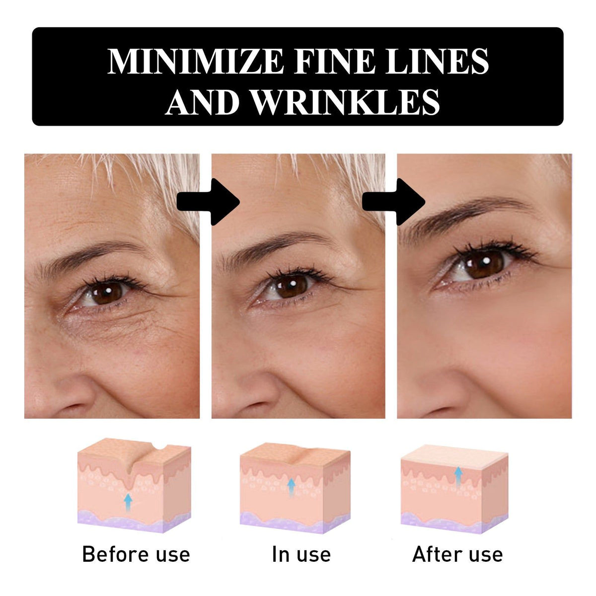 Ultimate Eye Lift and Moisturize Cream, Reduce Wrinkles, Dark Circles, Puffiness ,30ml