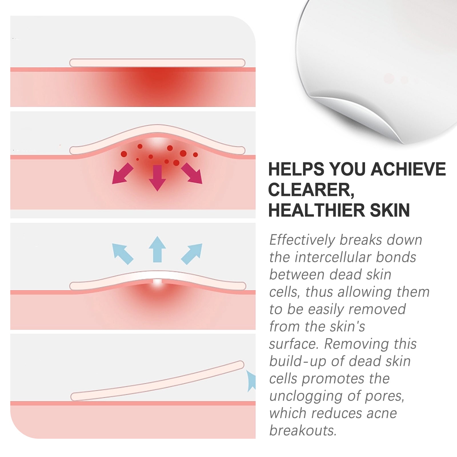 Acne Patch, Purify Pores, Clear Pimples, Invisible Breathable Acne Spot Treatment ,720pcs