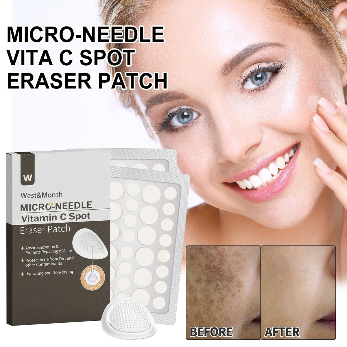 Fade Dark Spots with Micro-needle Vitamin C Patch, Acne & Blemish Repair ,72pcs