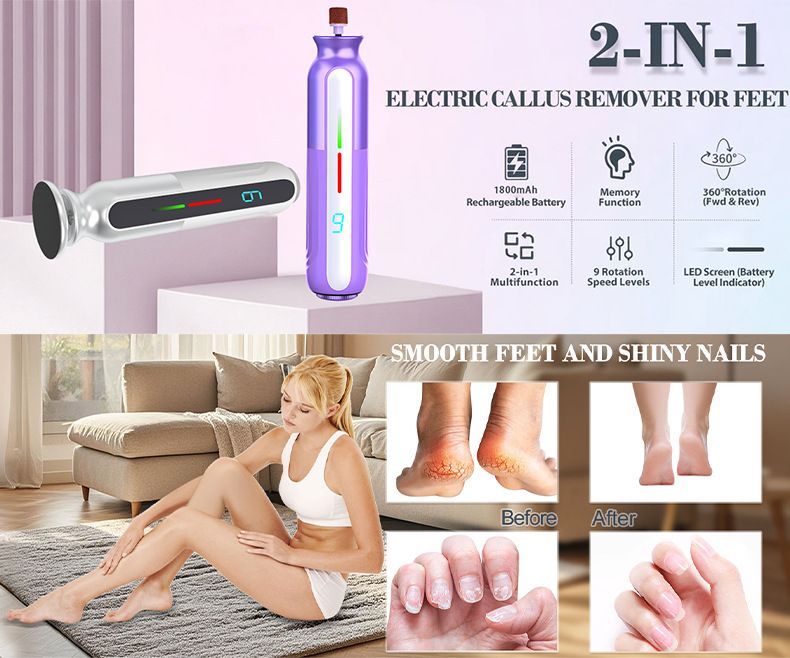 Portable USB Foot Callus Remover
