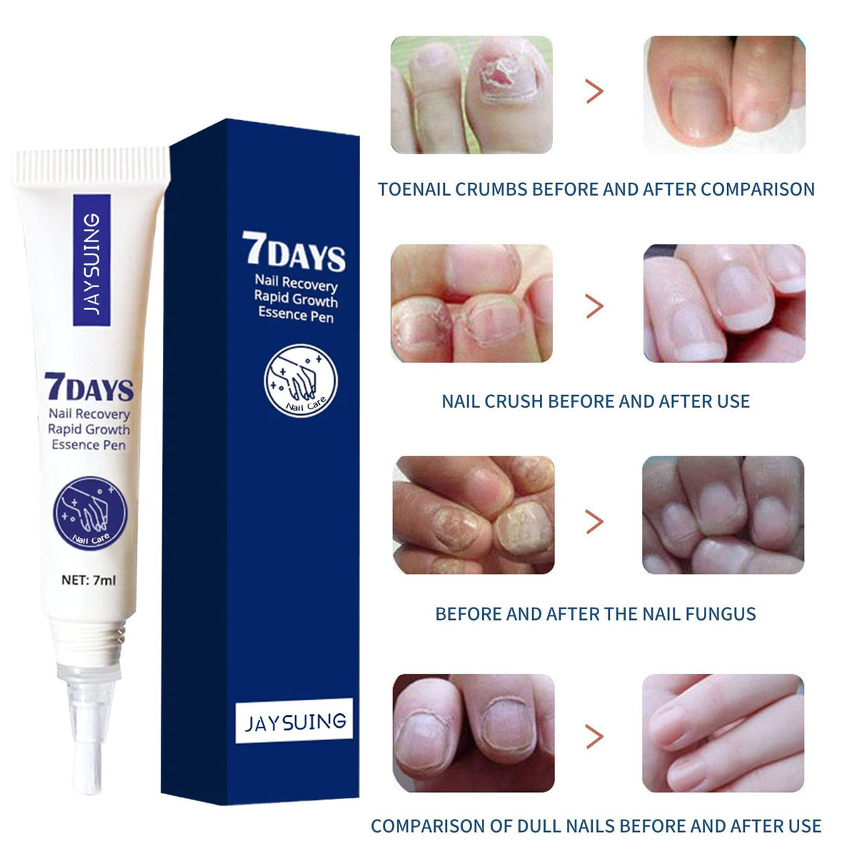 7 Day Nail Repair Serum for Stronger Faster Growing Nails, Fungal & Gray Nail Treatment ,7ml