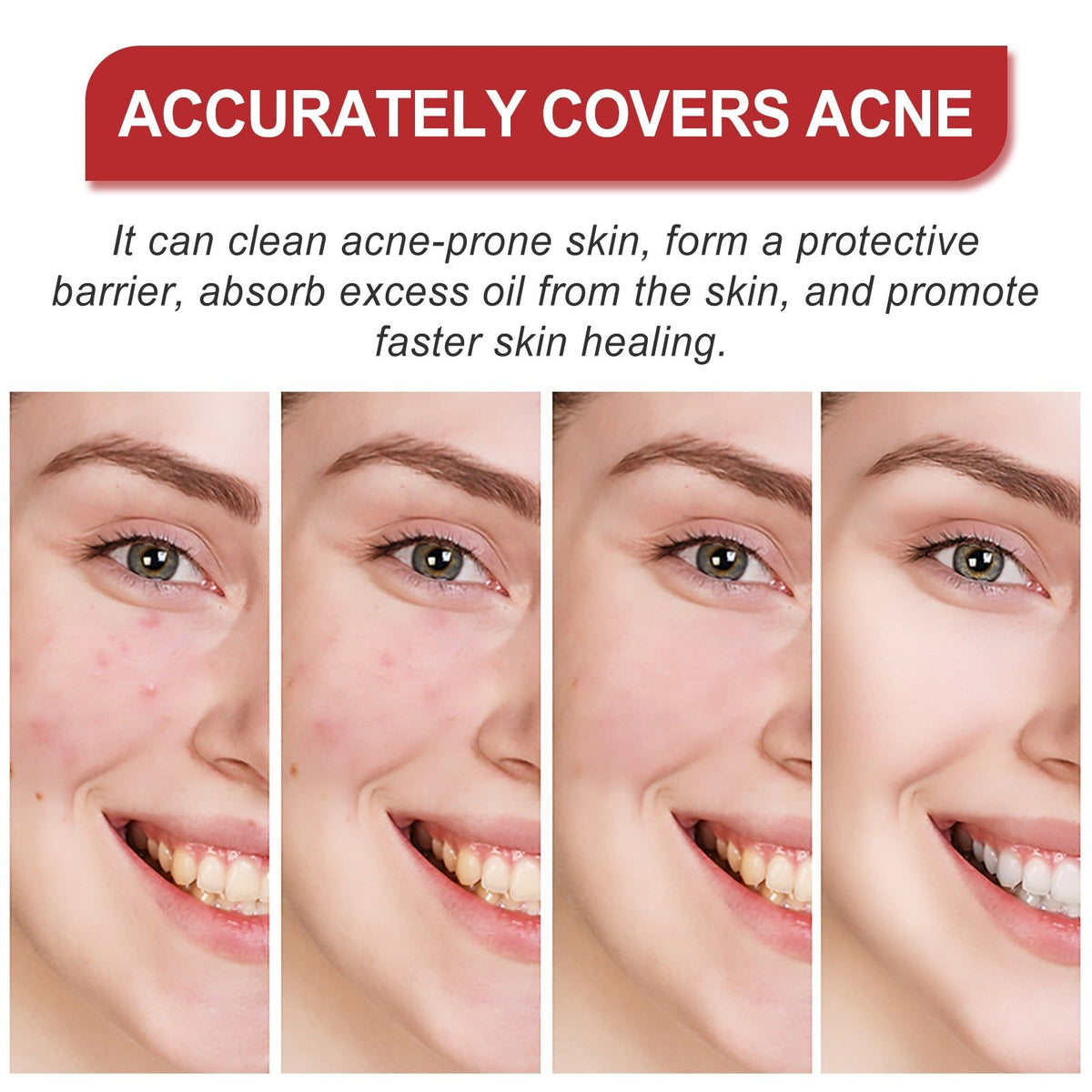 Facial Care Acne Patches, Clear Skin, Pimple Spot Treatment, Pore Cleanser ,180 patches