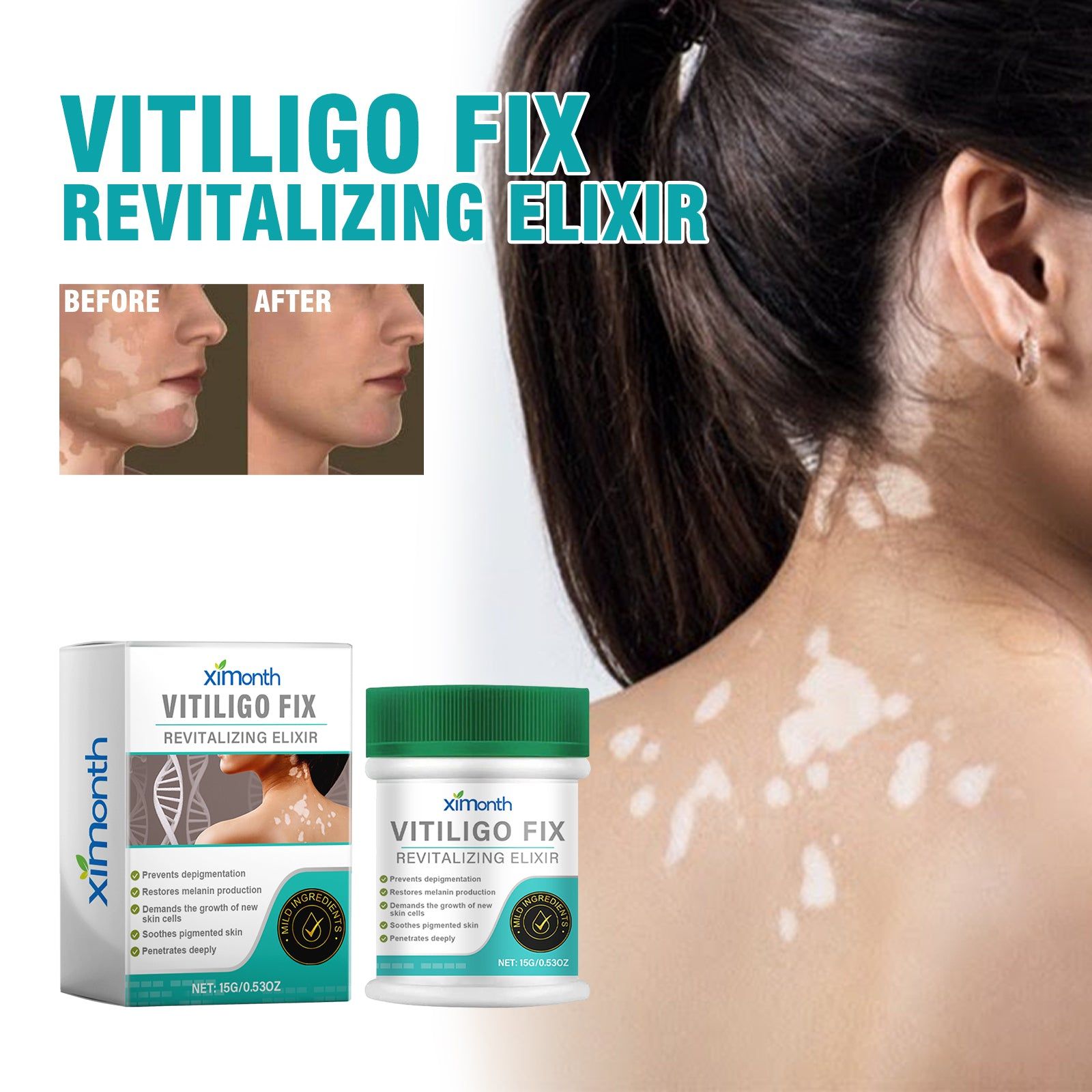 Revitalize Skin Care for Vitiligo, Lighten Spots, Even Tone, Moisturizing Repair ,15g